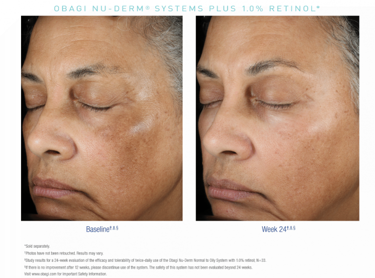 Obagi Nu-Derm Fx® System – Normal to Dry