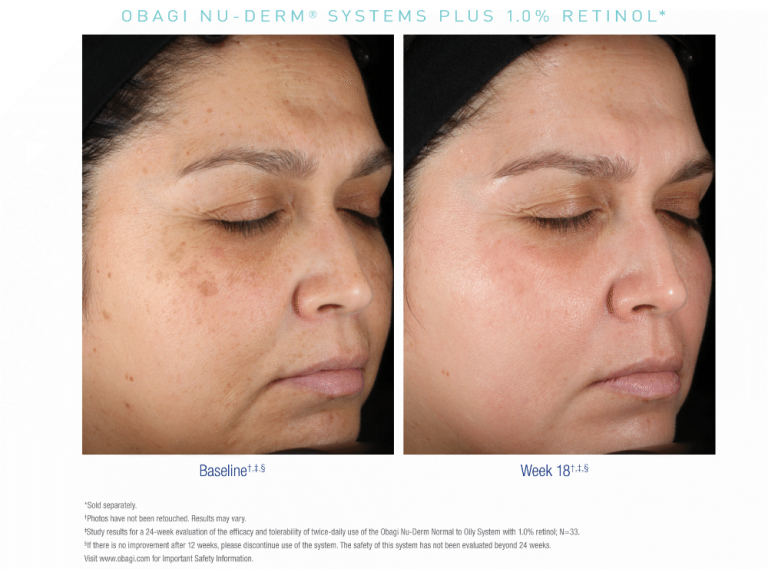 Obagi Nu-Derm Fx® System - Normal to Oily