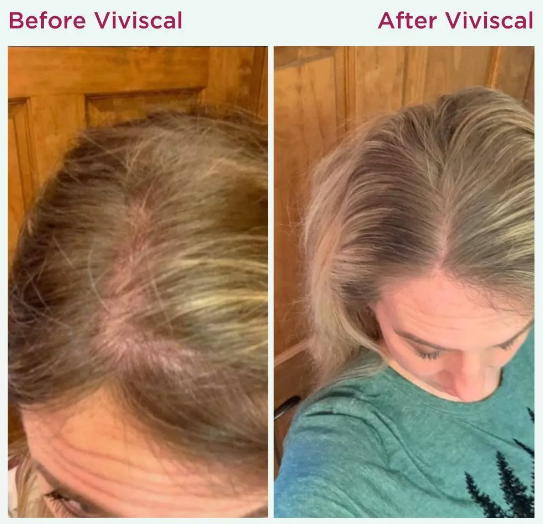 Viviscal Gorgeous Growth Densifying Shampoo